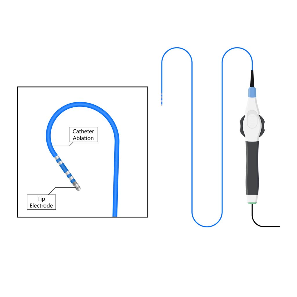 catheter-proximal and distal end wire stripping