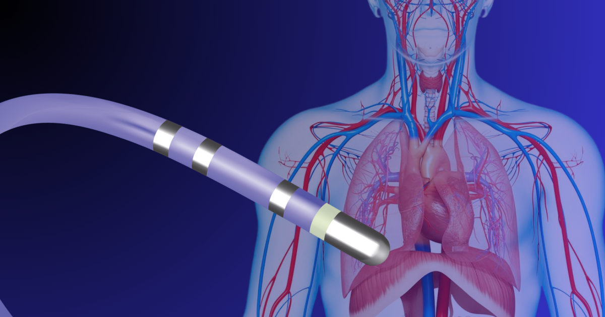 laser wire stripping ep catheter manufacture pfa catheter, ep catheter, process development